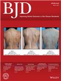 BRITISH JOURNAL OF DERMATOLOGY