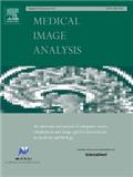 MEDICAL IMAGE ANALYSIS