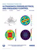 IEEE TRANSACTIONS ON ULTRASONICS FERROELECTRICS AND FREQUENCY CONTROL